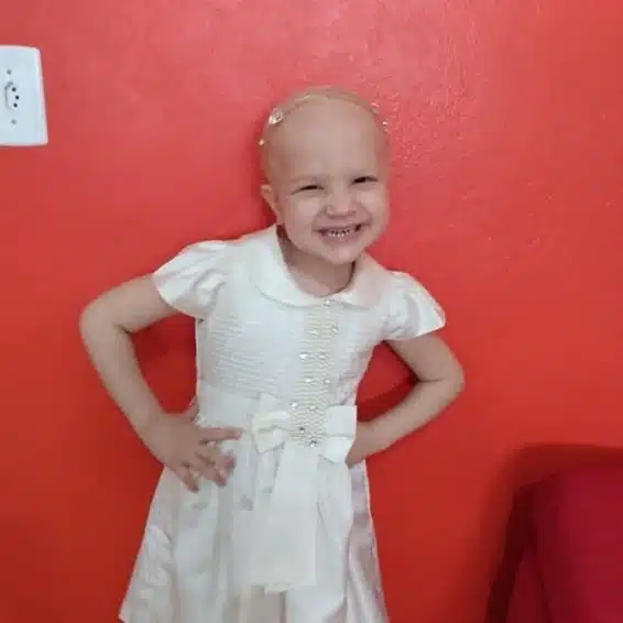 Menina de vestido e sem cabelos, em fase de tratamento da leucemia - câncer infantil, sorrindo.